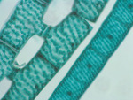 MISSING THUMBNAIL